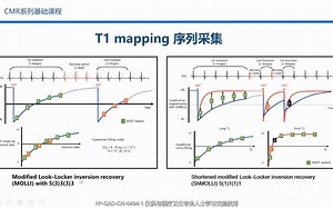 4CMR参数定量技术