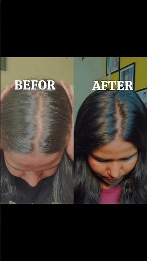 DIY Hair Mask for Soft & Shiny Hair ✨ | Curd + Aloe Vera + Coconut Oil + Multani Mitti | #hairmask