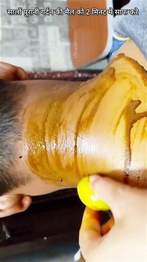 Dark Neck, Body Tan, Dark Knee Removal Home Remedy #shorts #shortsvideo #ytshort #darkneck