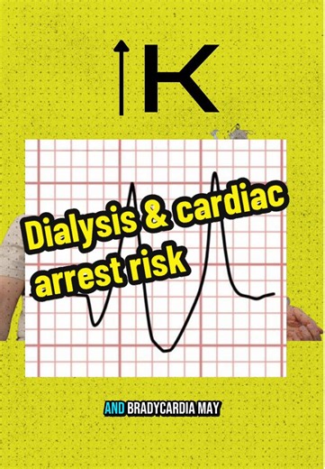 Understanding Cardiac Arrest Risks in Dialysis Patients