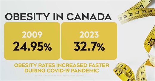 'We must treat obesity as a chronic disease': Doctor on pandemic-related rise in obesity rates