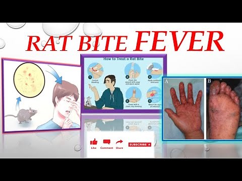Rat Bite Fever Disease|Symptoms and Casues of Rat Bite Fever in Human| Zoological Insight with Eram|