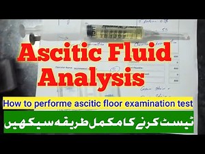 Ascitic Fluid Examination Test|Ascitic fluid analysis|ascitic fluid