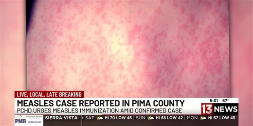 Pima County reports first measles case since 2019