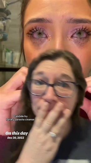 Kim Rogers Worm Queen🪱👸🏼 on Instagram: "man candida can affect your joints oral health eyes ears nose! Cleansing regularly with ParaFy parasite cleanse kit will help so much! We use Oregon grape root and Usnea to help combat candida! Doing the whole ParaFy kit will help since we include a binder and heavy metal detox! They all are hanging out together! Also candida is a parasite so we want to defuse that as fast as possible! #candida #wormqueen #candidadetox #parasitecleanse #gut"