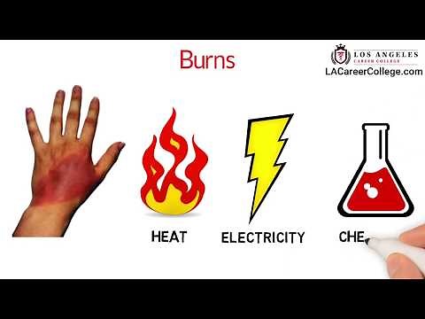 LACC | Burn | Electrical Injury | American Heart Association