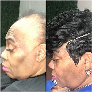 Woman with Alopecia gets the most amazing hair transformation! | Make-Up & Hair Tutorials