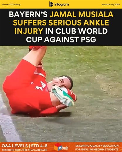 Bayern Munich star Jamal Musiala sustained a serious ankle injury during the FIFA Club World Cup 2025 quarterfinal match against Paris Saint-Germain at Atlanta’s Mercedes-Benz Stadium on Saturday. The 22-year-old German midfielder went down in stoppage time of the first half while chasing a loose ball in PSG’s penalty box. As he attempted to reach it, PSG goalkeeper Gianluigi Donnarumma got to the ball first but collided heavily with Musiala in the process. The impact left Musiala visibly in pai