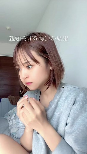 親知らずを抜いた結果 - 顔が腫れて二重顎になりました