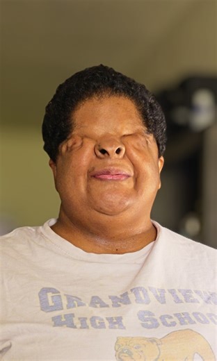 I was born without eyes - but still raised 2 kids alone ❤️ | My Extraordinary Family