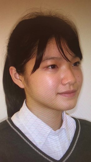 歯列矯正で人生が変わった私の体験