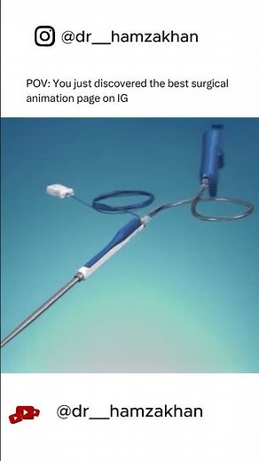 Turbinate Reduction Explained in 60 Seconds | Breathe Better Fast!