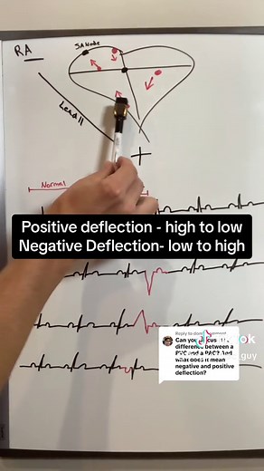Replying to @dom PVC vs PAC and read an EKG #learnontiktok #tiktokpartner #fyp #nursingstudent #nurse #ekg #medtok