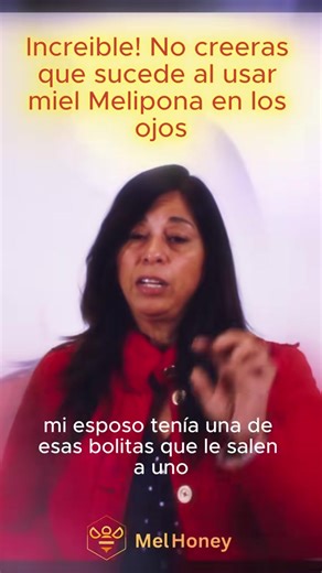 Natural Remedies for Cataracts and Dry Eyes