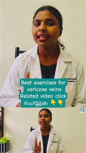 Best exercises for varicose veins | shorts| draryasudarsanan