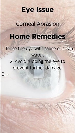 Corneal Abrasion First Aid: Quick Relief Tips You NEED to Know!