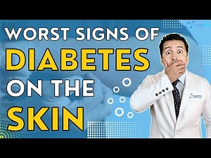 What Happens To Your Skin Due To Diabetes & How to Care Of Them! ￼