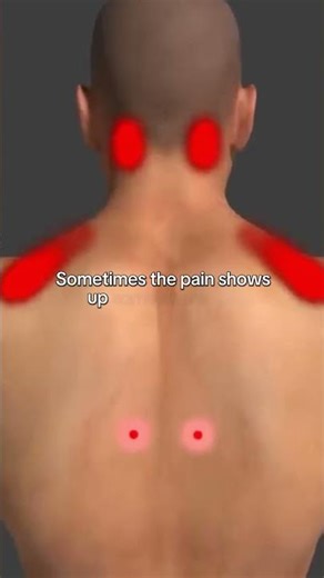 Tight, sore spots that just won’t relax? Those could be trigger points. 🔴