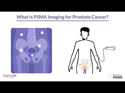 What Is PSMA Imaging? | Prostate Cancer Diagnosis