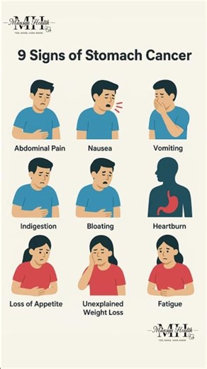 Signs of stomach cancer