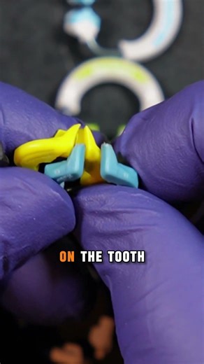 Which sectional matrix ring is the best?