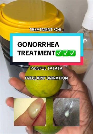 Gonorrhea Treatment Kit Available - Order Now