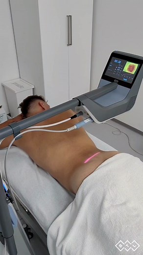 BTL presents an advanced high-intensity laser featuring a Robotic Scanning System, capable of treating areas ranging from small to large, up to 1200 cm2. This automated scanning system ensures an even distribution of energy, particularly beneficial for addressing the entire back, large muscle groups, and joints. Get to know the BTL Robotic Scanning System with this short video: -> https://www.youtube.com/watch?v=LKDWg_JTQRI | BTL Medical International