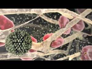 Atherosclerosis (2008)