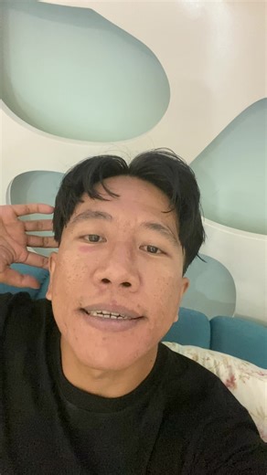 Effective Treatment for Acne Scars at CellScience