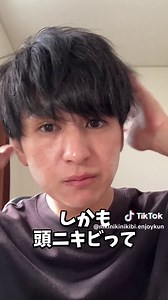 頭皮ニキビとさよなら！ニキビの治し方と頭皮ケア方法