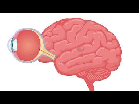 Animated Visual Electrophysiology