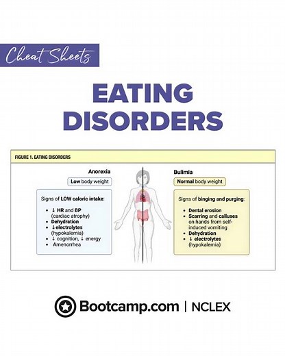 🧠 Eating Disorders: Anorexia vs. Bulimia — Know the NCLEX Differences | NCLEX Bootcamp Cheat Sheet