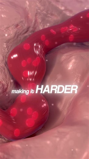 Poor Posture Can Slow Blood Circulation to Your Legs