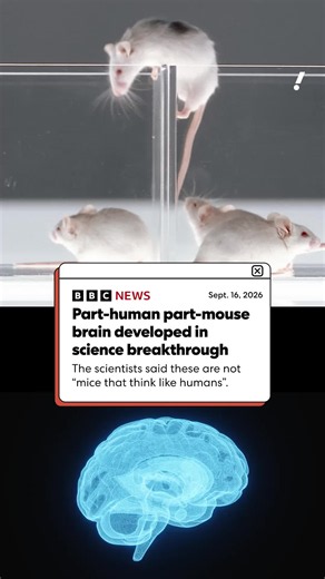 Mice with human brain cells implanted — Stanford research explained