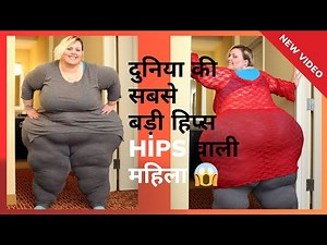 Bobbi-Jo Westley – The Woman Who Wanted the World’s Biggest Hips