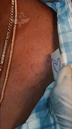 A black and red heart tattoo shows pain and love together—symbolizing heartbreak, healing, and hope.