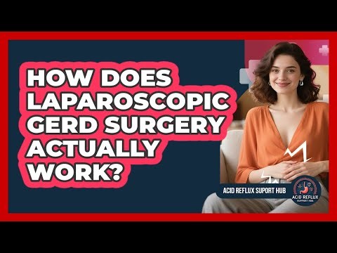How Does Laparoscopic GERD Surgery Actually Work? - Acid Reflux Support Hub