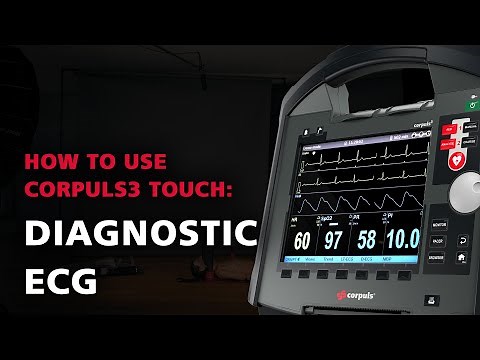 Tutorials by corpuls [en] corpuls3 diagnostic ECG
