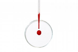 We Already Know a Way to Save a Bunch of Lives. There’s a Really Dumb Reason We Aren’t Doing It.