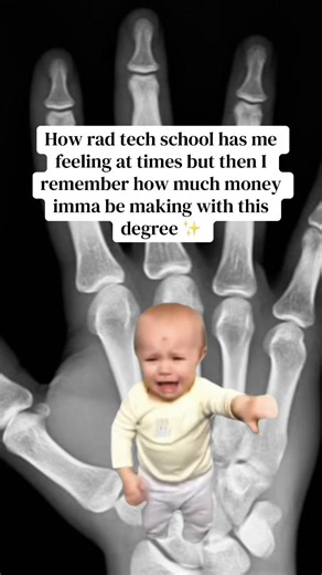 Navigating Rad Tech School with Hope