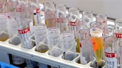 9 otázok a odpovedí o anabolických steroidoch: Aké je najväčšie riziko ich užívania?