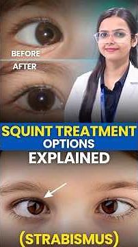 Squint Treatment & Surgery | Squint Treatment Options Explained