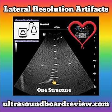 Lateral Resolution Artifacts, Ultrasound Artifacts, Ultrasound Physics Registry Review, Exam Review