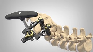 MAS TLIF 2 - Product Animation