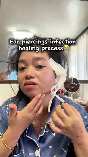 Ear Piercing Infection: A Personal Experience