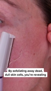2.7M views · 586 reactions | If you have peach fuzz, you may want to consider doing this... Get rid of peach fuzz and instantly reveal smoother, softer, more radiant skin with the Sonicsmooth 2-in-1 dermaplaning system. ✨ Exfoliates away dead and dry skin⁠ ✨ Removes peach fuzz ✨ Will not make your hair grow back thicker or longer⁠ ✨ Safer to use than a $2 drug store razor | Michael Todd Beauty | Facebook
