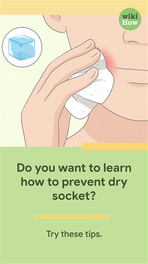 3 Tips to Prevent Dry Socket After Extraction