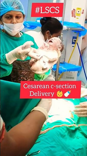 welcome to new world👶||#csectionbirth #lscs#newborn#newbornbaby#ytshorts #shortsfeed#shorts #viral