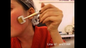 Derma roller นอกจากแก้ปัญหาริ้วรอยแผลเป็นจากสิวแล้ว นอกจากไม่ทำให้ผิวหน้าบางแล้ว Derma roller ยังไปประตุ้นให้ผิวสร้างบริมาณคอลาเจนและอีลานติน ดังนั้น derma roller ยังช่วยให้ผิวหน้าแข็งแร็งขี้นด้วย. สนใจสอบถามเพิ่มเติ่ม LINE ID :@ionic Call Office: 02-329-9171 | Derma Store