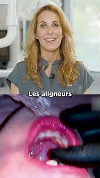 les aligneurs transparents